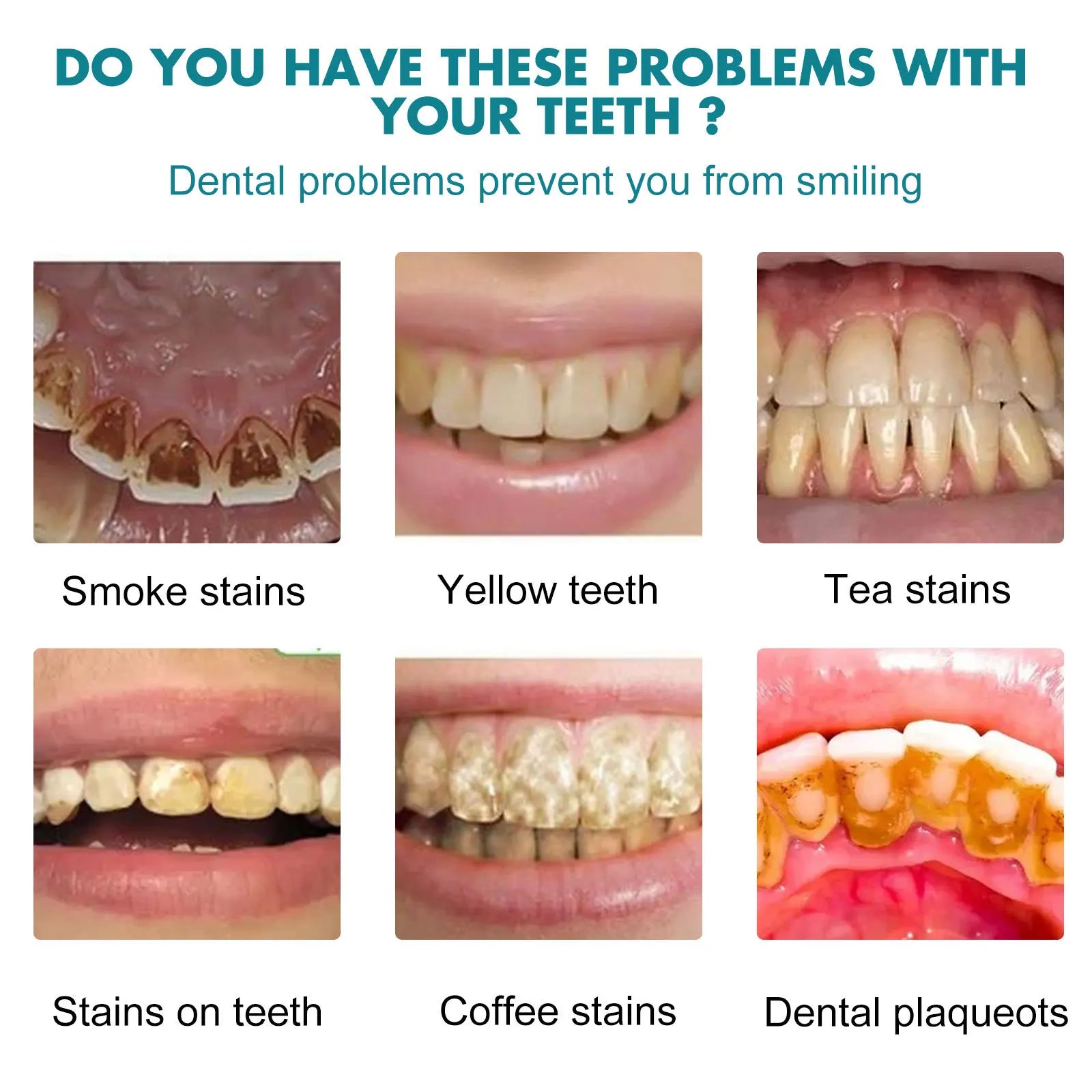 Teeth Whitening Paint — Instant Stain Cover & Brightening