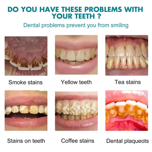 Teeth Whitening Paint — Instant Stain Cover & Brightening