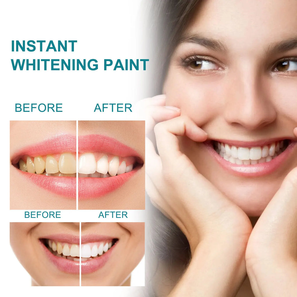 Teeth Whitening Paint — Instant Stain Cover & Brightening