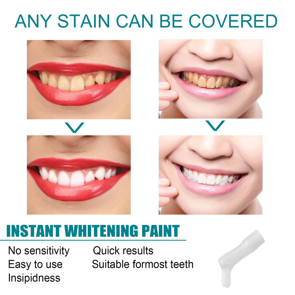 Teeth Whitening Paint — Instant Stain Cover & Brightening